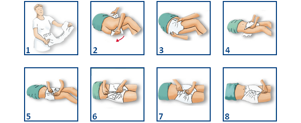 Technique de pose du Abri Form