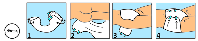 Technique de pose du Amd Slip