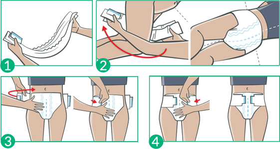 Pose du Molicare Elastic