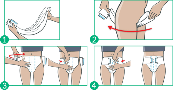 Pose du Molicare Elastic