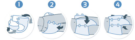 Technique de pose du iD Expert Slip