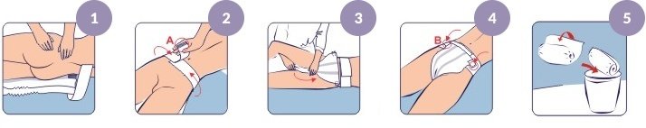 Technique de pose du Seni Optima